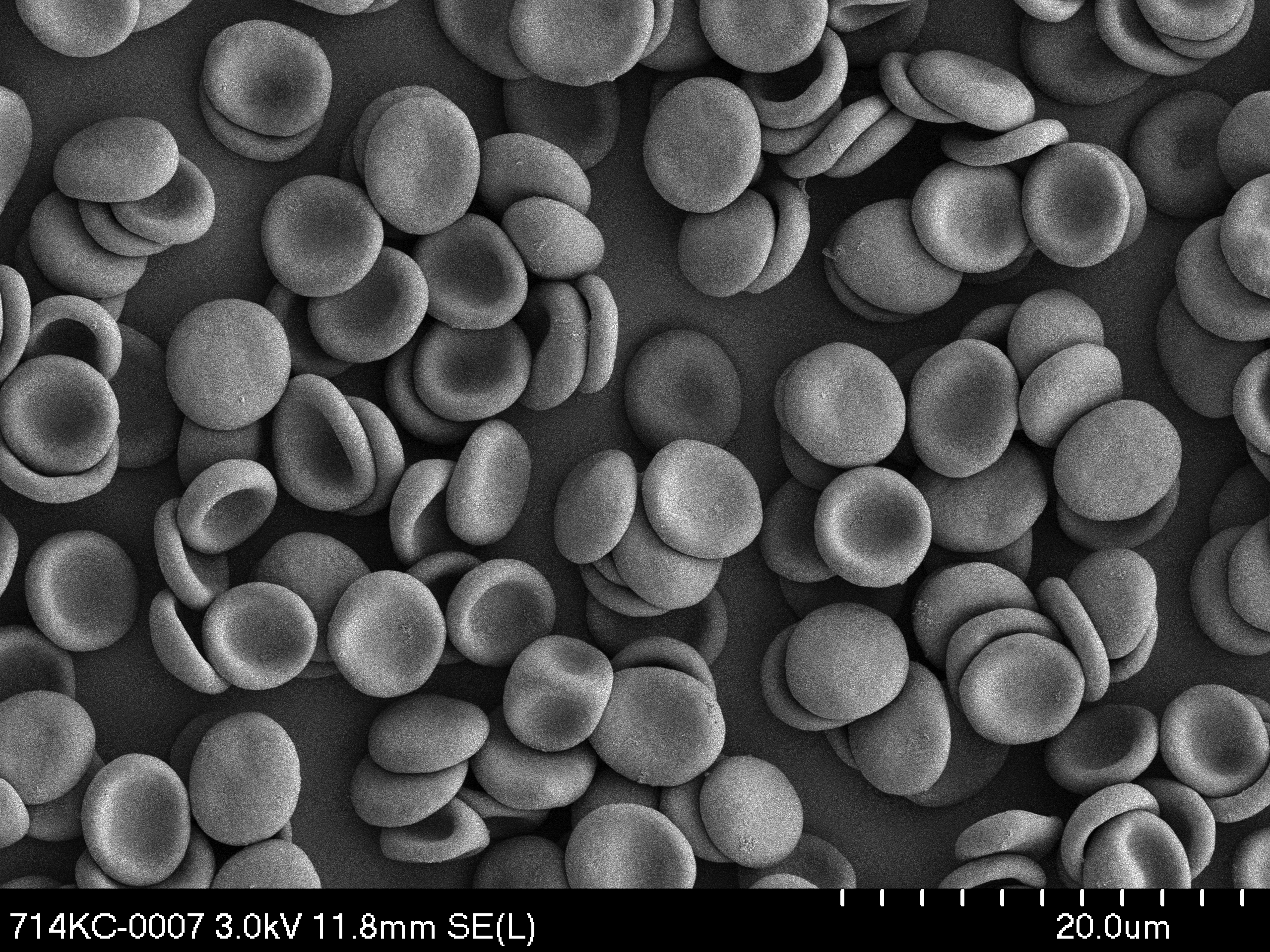 2015: Rote Blutkörperchen im Raster-Elektronenmikroskop