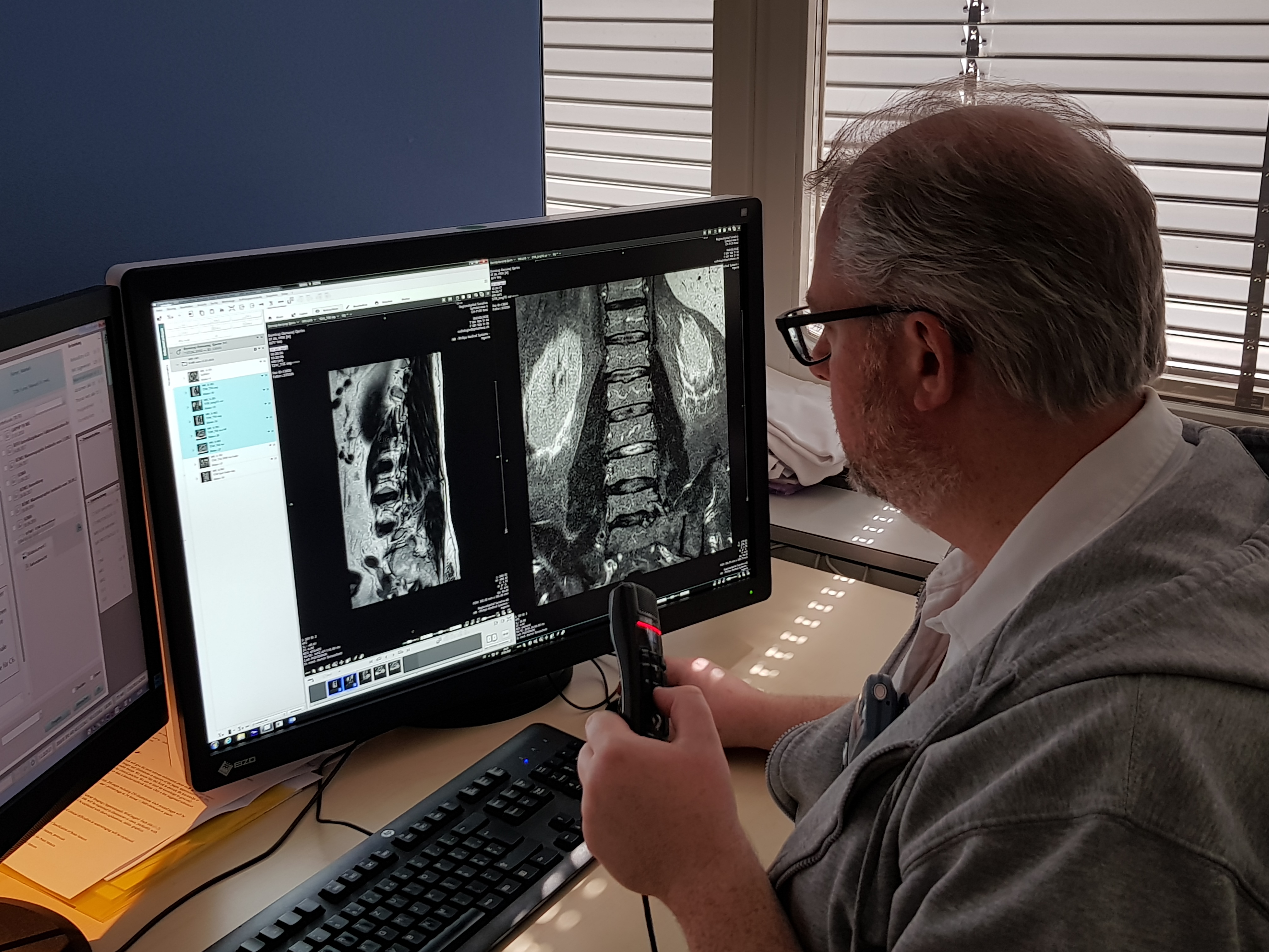 2017: Analyse eines MRI-Bildes
