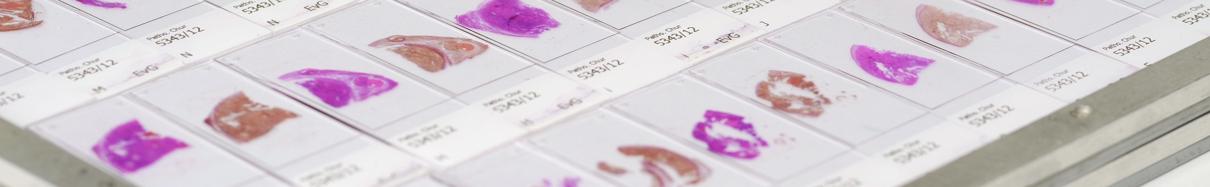 2012: Gewebeproben aus dem pathologischen Institut